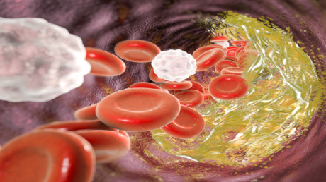 الكوليسترول 