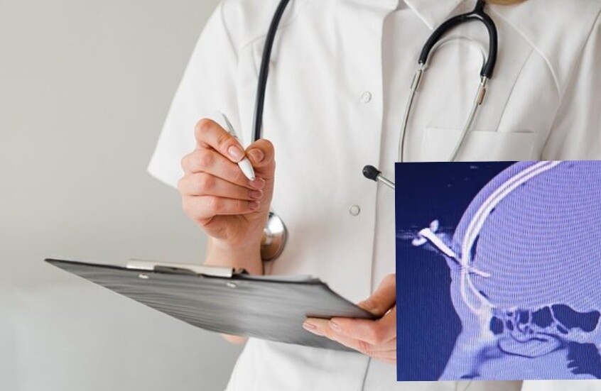 "مفتاح سيارة يستقر في جبينه".. لاعب سابق يتعرض لإصابة غريبة