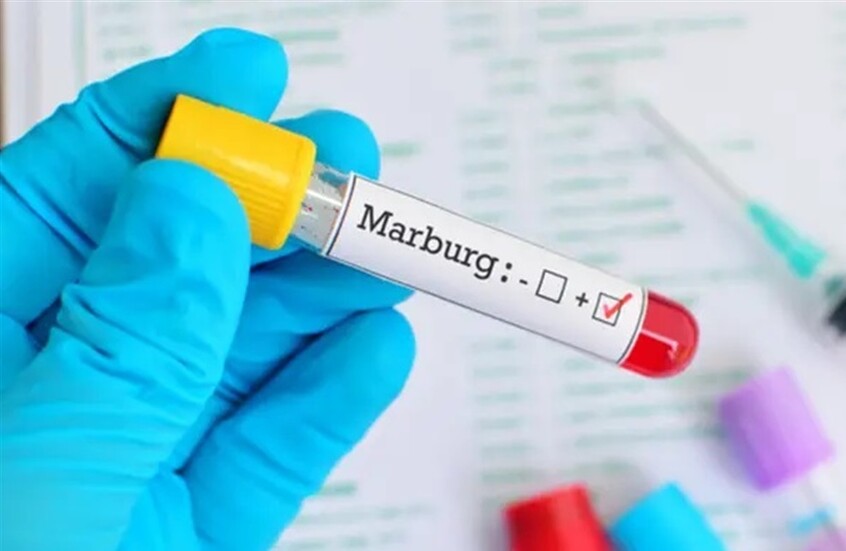 بعد مخاوف من انتشاره.. هل يهدد فيروس ماربورغ مصر؟