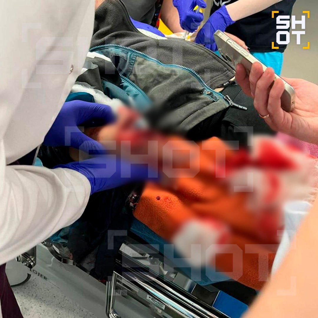 روسيا.. إصابة طفل بانفجار مفخخة على شكل هدية