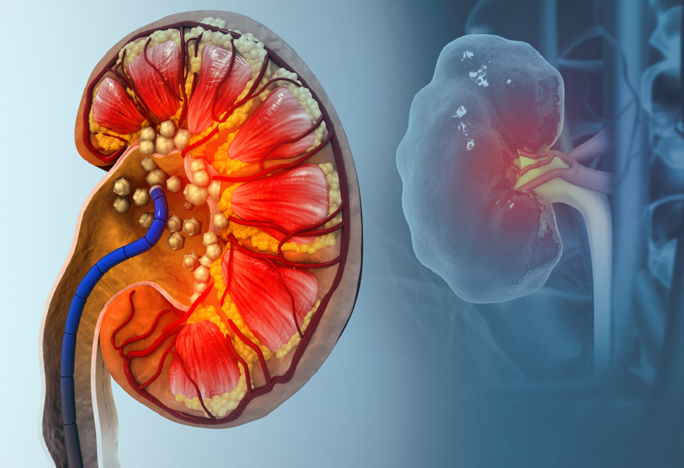 "بول الثعابين" قد يكشف عن طرق جديدة لعلاج النقرس وحصوات الكلى