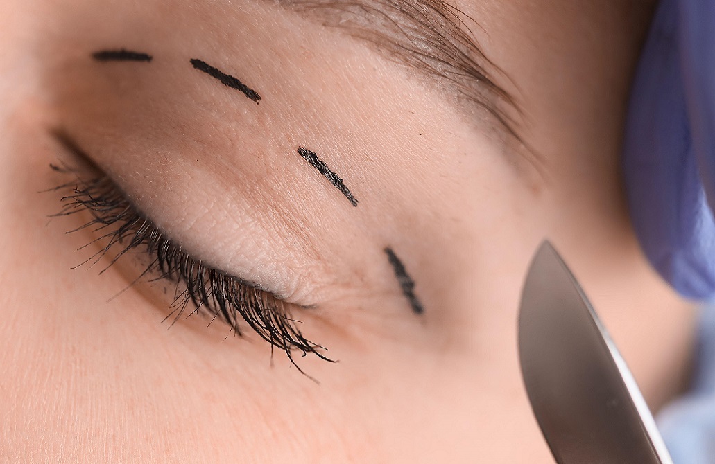 زوجة حاخام روسي رفيع تقاضي طبيبة جراحة تجميل وتطالبها بتعويض قدره 28 مليون روبل