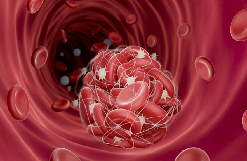 عادات يومية تزيد خطر تجلط الدم