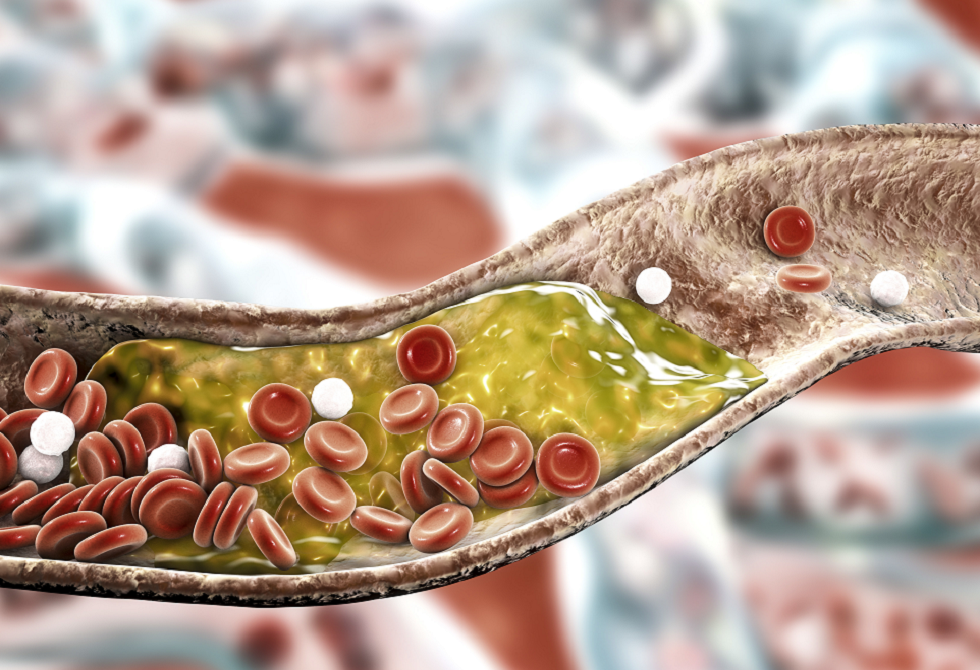 نتائج مذهلة خلال 30 يوما.. نظام غذائي يخفض الكوليسترول كما تفعل الأدوية
