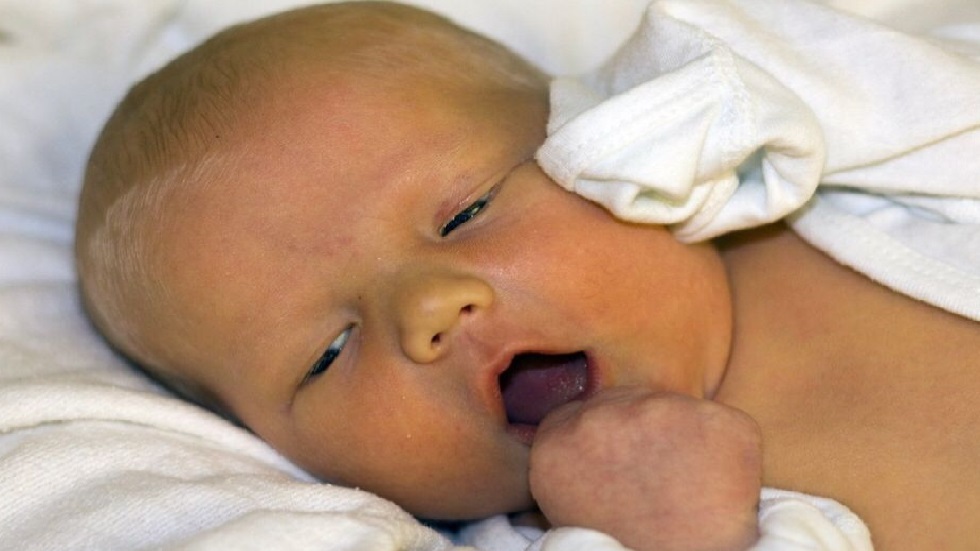 اليرقان وأسبابه ومضاعفاته الصحية