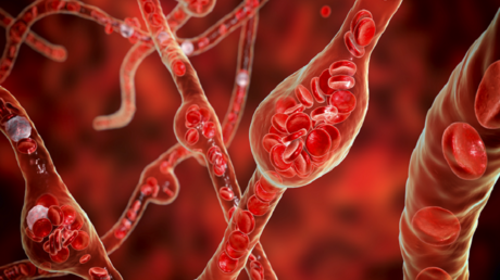  دواء قديم وشائع لضغط الدم قد يحد من نمو أورام الدماغ الخبيثة