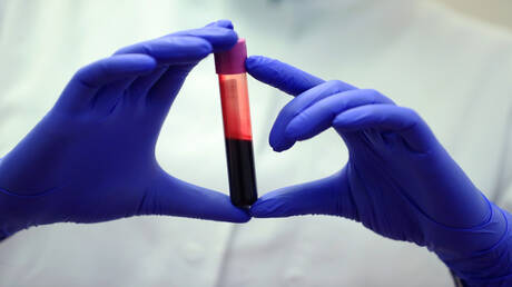 محاولات علمية حثيثة لاستنساخ "الدم الذهبي" النادر الذي يحمله 50 شخصا فقط حول العالم