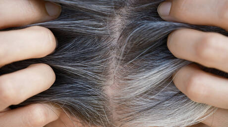 كيف تدمر عادة واحدة شعرك؟ التساقط والشيب المبكر