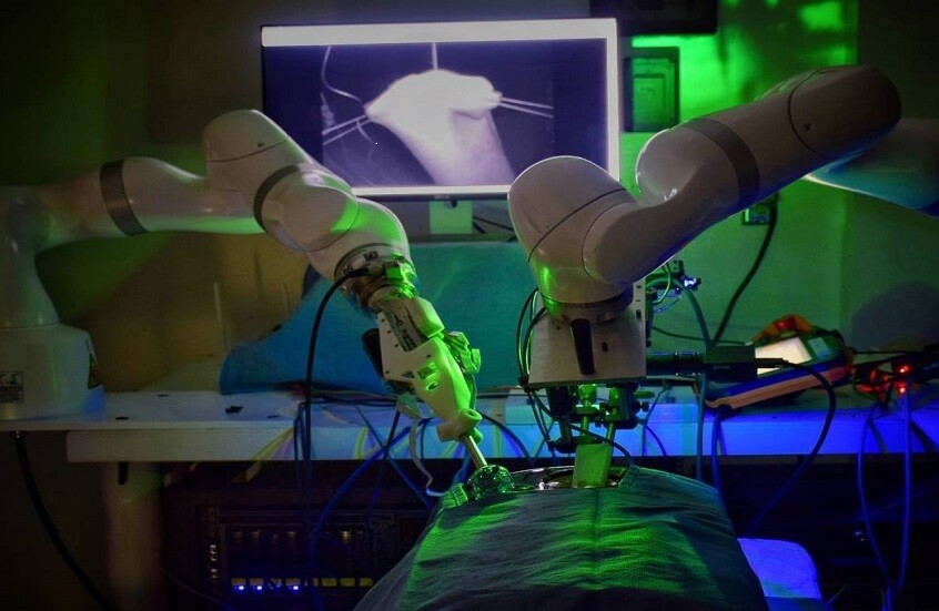 "الخياطة الذكية".. تقنية صينية لتعويض فقدان الإحساس اليدوي في الجراحة الروبوتية