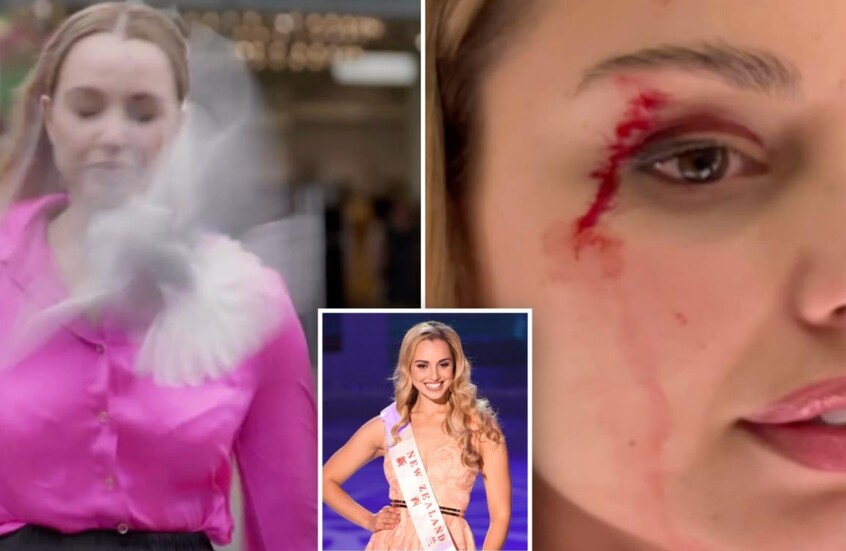 طائر يصطدم بوجه مراسلة نيوزيلاندية على المباشر ويصيبها بجروح (فيديو)