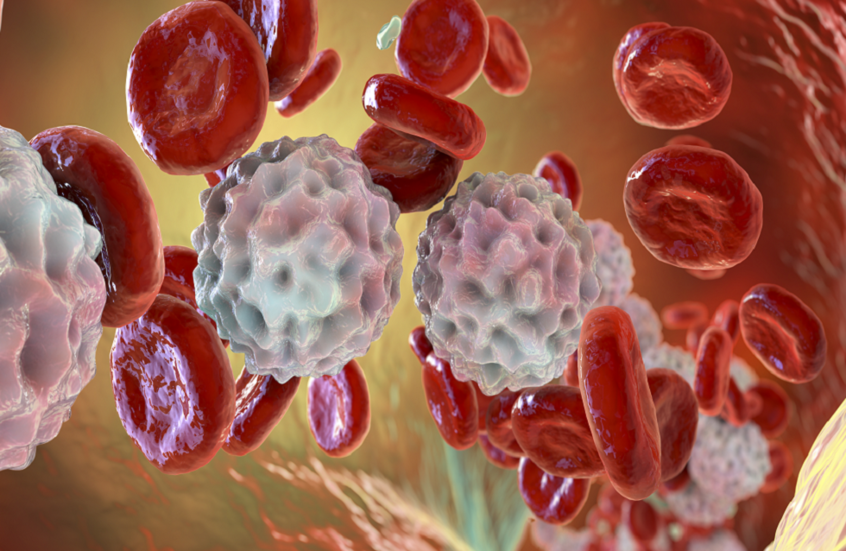 علاج ثوري يحقق نتائج واعدة في محاربة سرطان الدم المقاوم