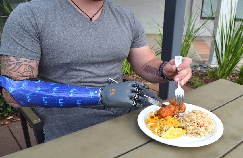 تطوير ذراع بيوني ذكي يعمل كطرف بشري طبيعي (فيديو)