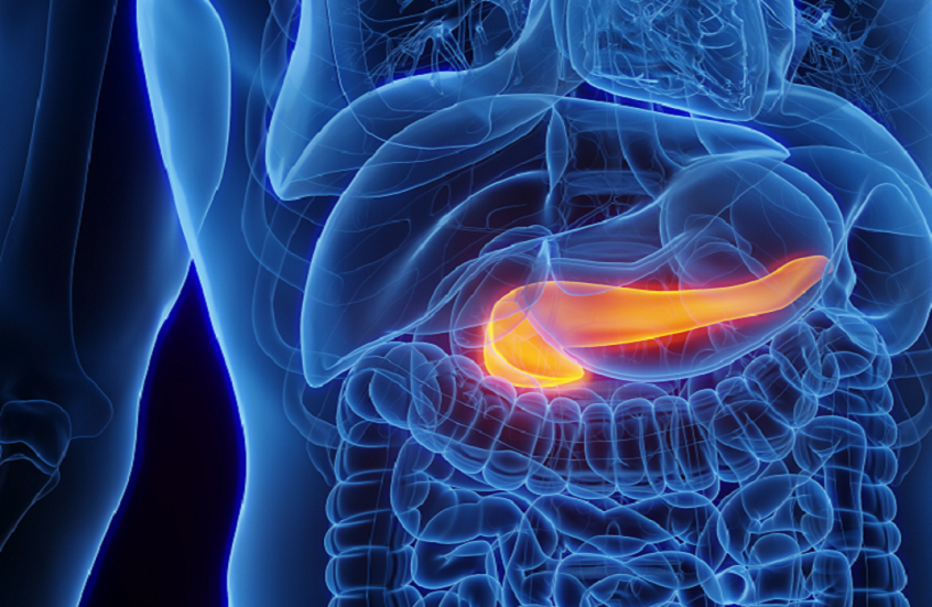 كشف علمي يمهد الطريق للتنبؤ بسرطان البنكرياس عبر "بصمة وراثية"