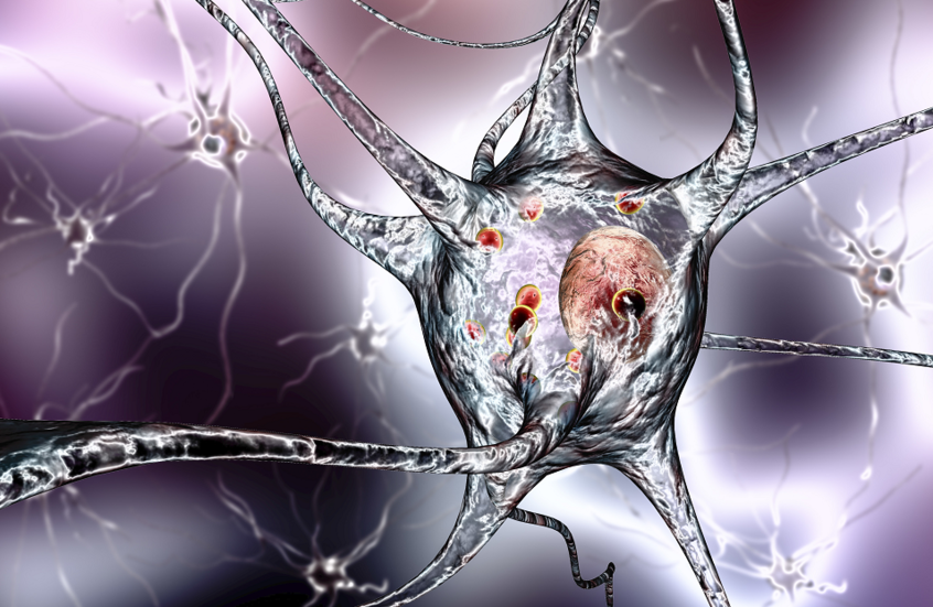 دواء شائع للهربس قد يفاقم ألزهايمر المبكر