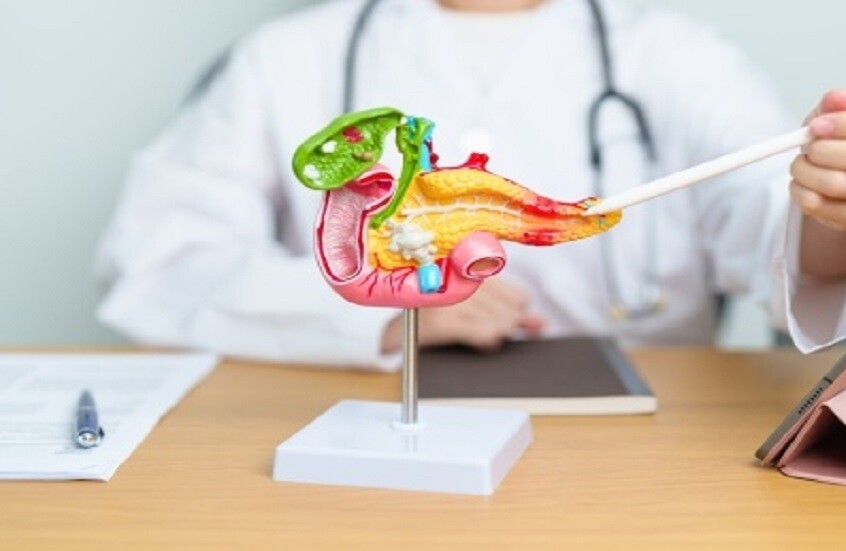 التهاب البنكرياس الحاد.. نصائح لتجنب المخاطر أثناء الأعياد والاحتفالات