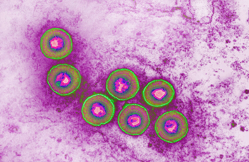 استراتيجية جديدة لعلاج أنواع نادرة من السرطان