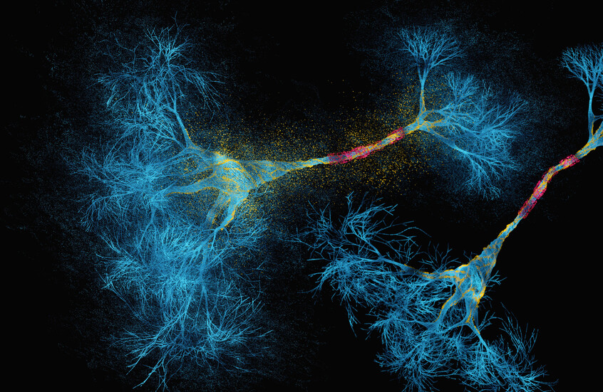 الذكاء الاصطناعي يعيد تعريف التصلب المتعدد: اكتشاف نوعين جديدين للمرض العصبي المعقد