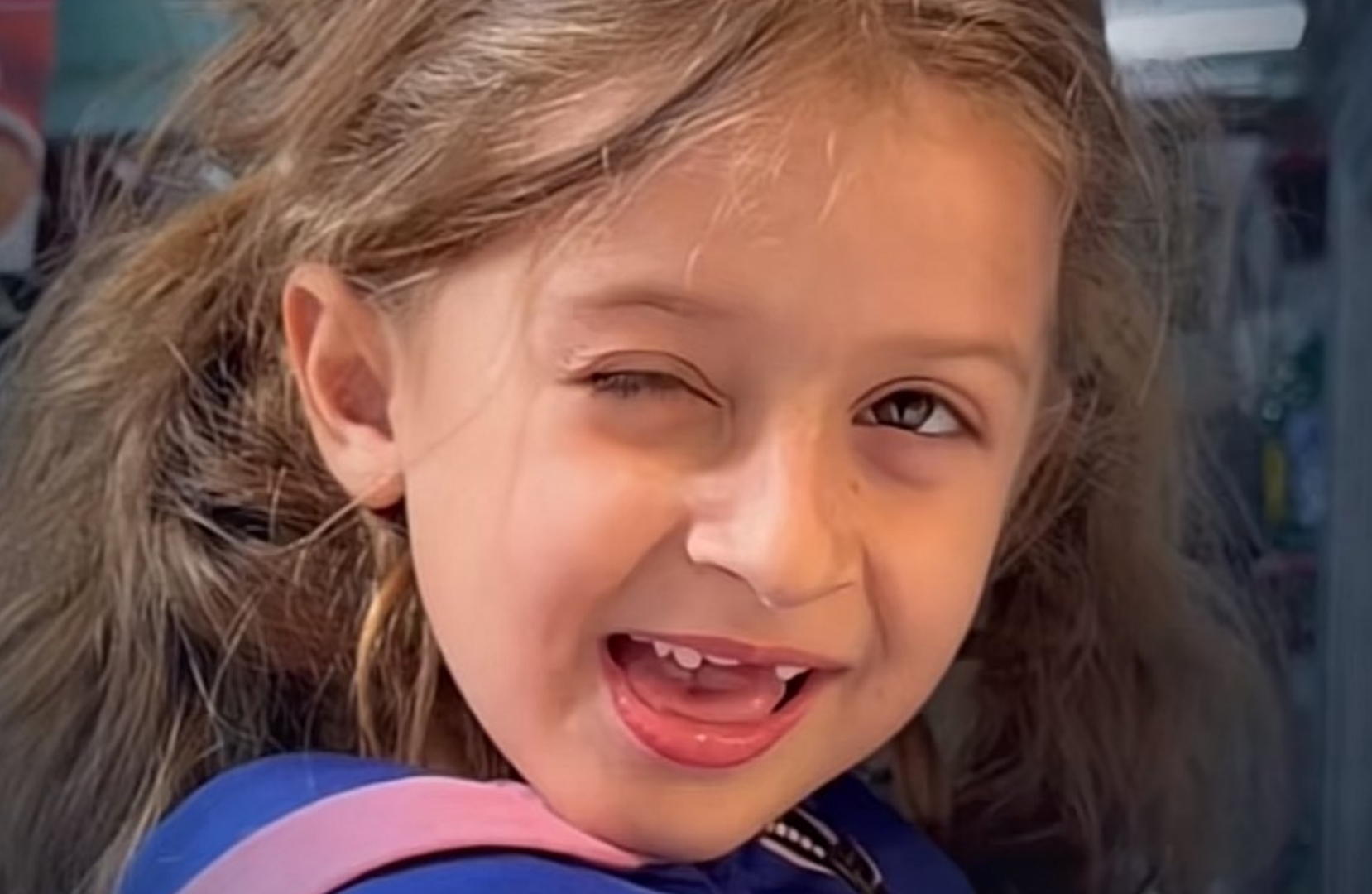 بدعم من صانع محتوى سعودي.. نجاح عملية الطفلة السورية إيلين (فيديو)