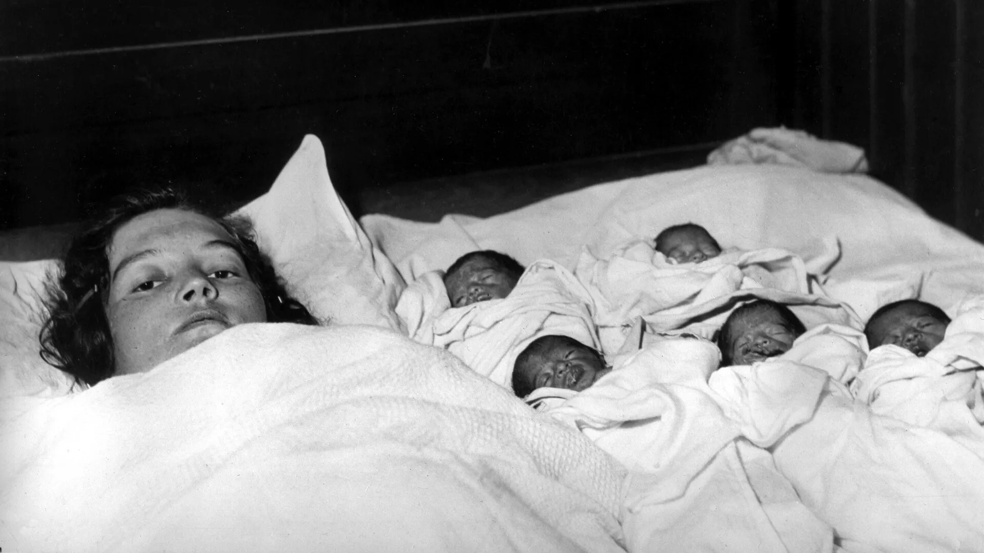 وفاة آخر توائم المعجزة الكندية التي أدهشت العالم (صور)