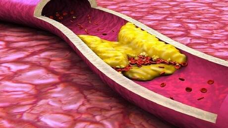 فاكهة تخفض مستوى الكولسترول في الدم