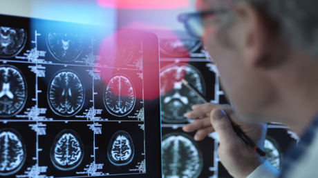 دواء لألزهايمر يحقق نتائج مذهلة في تأخير المرض 8 سنوات