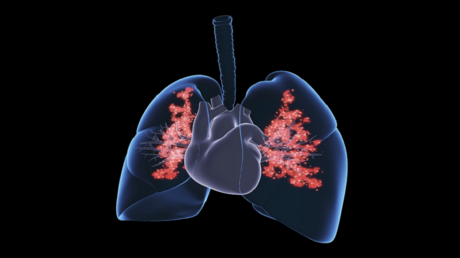 عدوى رئوية شائعة ترفع خطر الإصابة بأمراض القلب