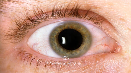 تأثير خفي لمرض السكري على صحة العين