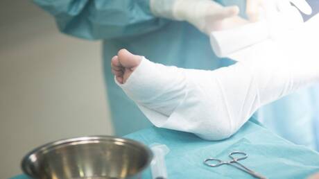 إنجاز طبي روسي.. إجراء أول عملية لزراعة طرف اصطناعي بالاندماج العظمي