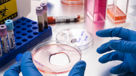 مؤشر حيوي جديد لمحاربة ارتفاع ضغط الدم وداء السكري