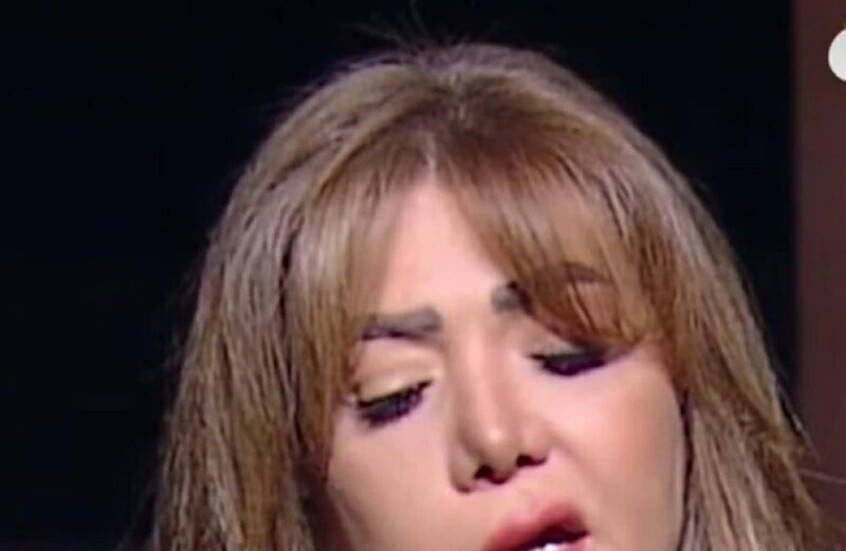 فنانة مصرية شهيرة تروي مأساة إصابتها بـ"شلل الوجه"