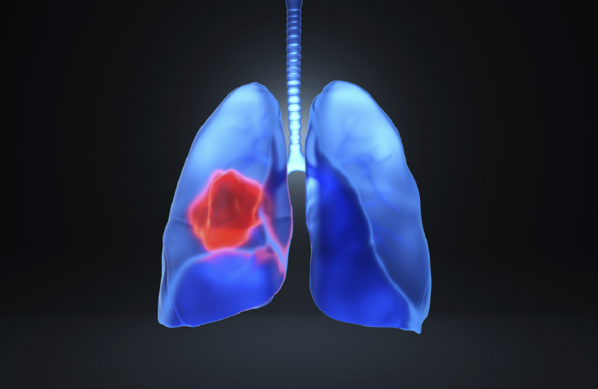 دراسة روسية: الإقلاع عن التدخين أكثر فاعلية من بعض أدوية السرطان الحديثة