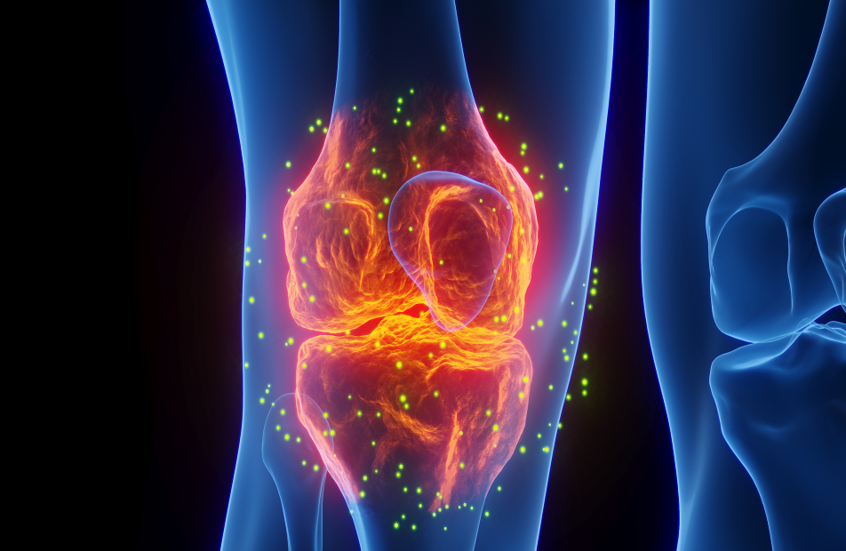 مركبات في الأطعمة النباتية تحمينا من هشاشة العظام