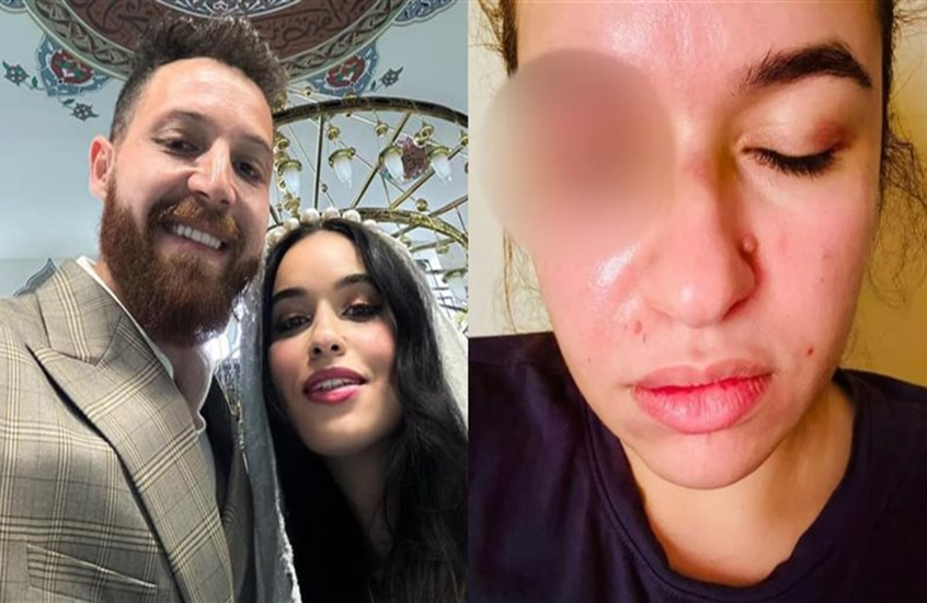 بعد اتهامه بضربها.. فنان مصري يكشف سر خلافاته الحادة مع زوجته