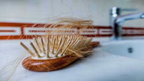 ارتباط بين تساقط الشعر وأمراض خطيرة