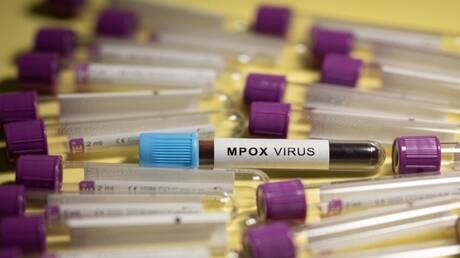 رصد طفرة مستمرة لفيروس جدري القرود