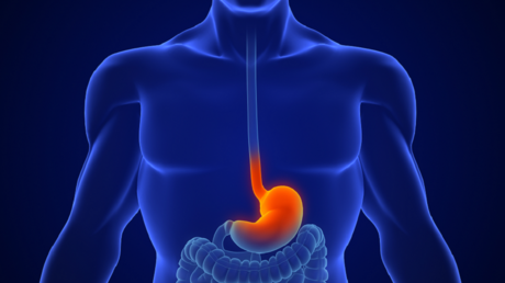 دراسة تدحض علاقة أدوية الحموضة بسرطان المعدة
