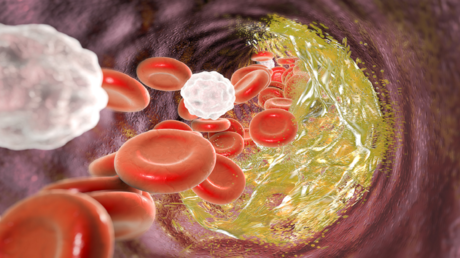 غذاء بسيط قد يحدث فرقا في صحة القلب وخفض الكوليسترول 