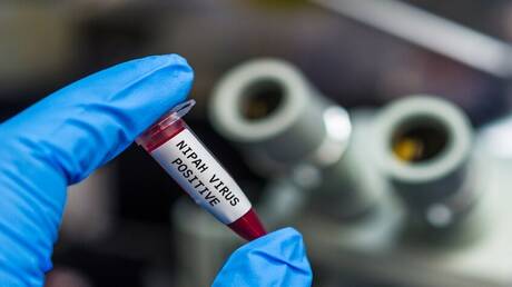 صحيفة: شركة صينية طورت اختبار PCR لفيروس نيباه وهي جاهزة لطرحه في السوق