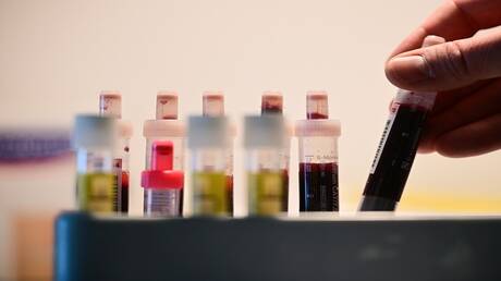 فحوصات سنوية أساسية تكشف الأمراض قبل ظهور الأعراض 