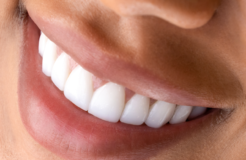 سلاح طبيعي لحماية الأسنان من التسوس