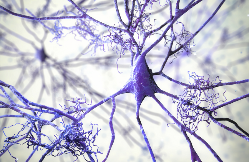 دواء شائع للصرع "يحارب" ألزهايمر قبل ظهور الأعراض