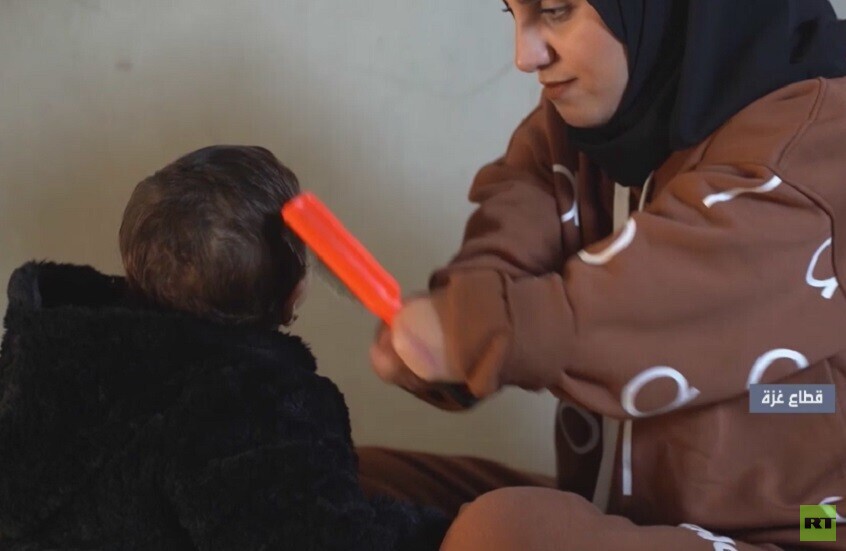 مبتورو الأطراف.. قصص تجسد بشاعة الحرب