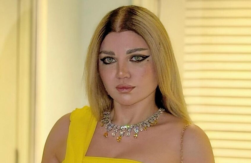 ياسمين الخطيب تتعرض لعدوى حادة تغير ملامح وجهها (صورة)