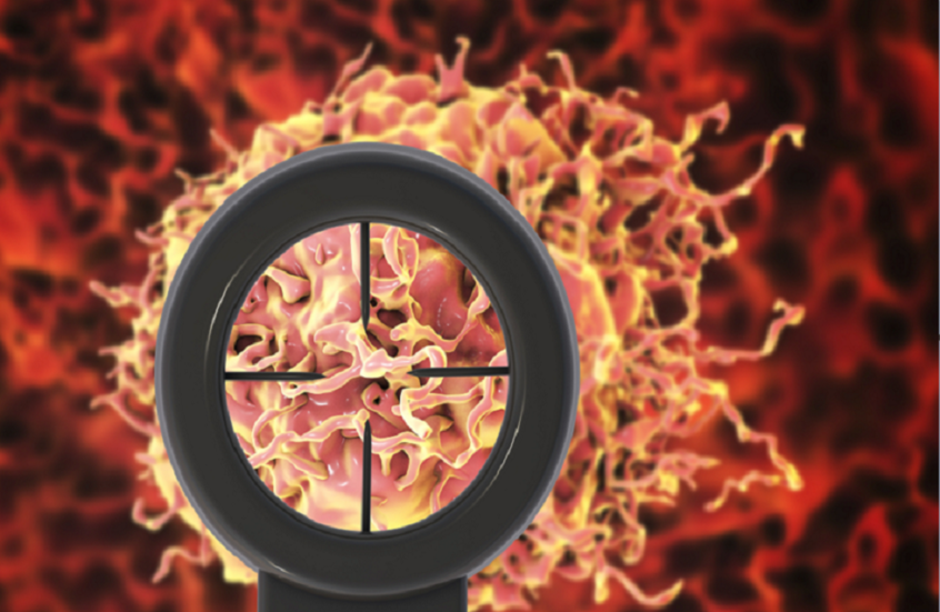 استراتيجية مبتكرة لعلاج سرطان البروستات في مراحله الأولى