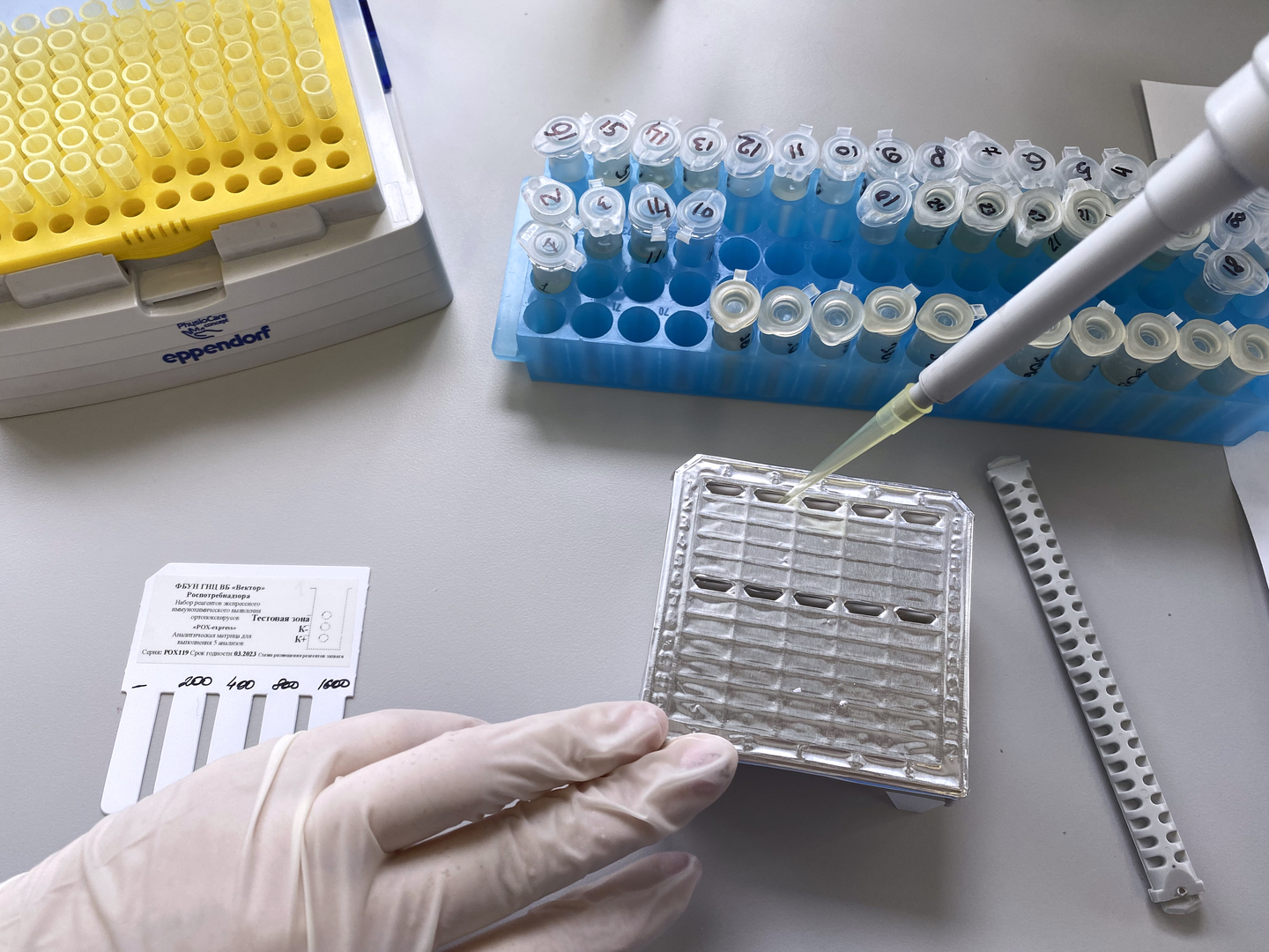 اكتشاف إصابتين بجدري القردة في روسيا