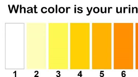 لون البول إلى ماذا يشير؟ 