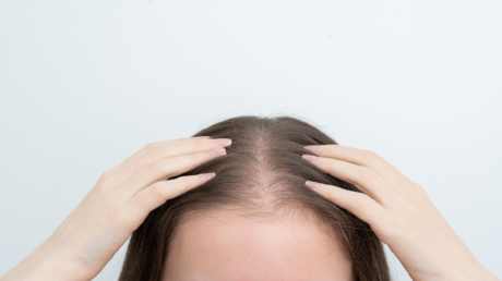 ابتكار كوري جديد يكبح تساقط الشعر بنسبة 92%