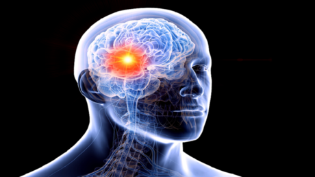 اكتشاف سبب غير متوقع يزيد خطر الإصابة بأورام الدماغ .. عاجل 