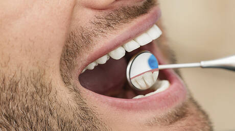 اكتشاف سبب غير متوقع لتدهور صحة الفم والأسنان 