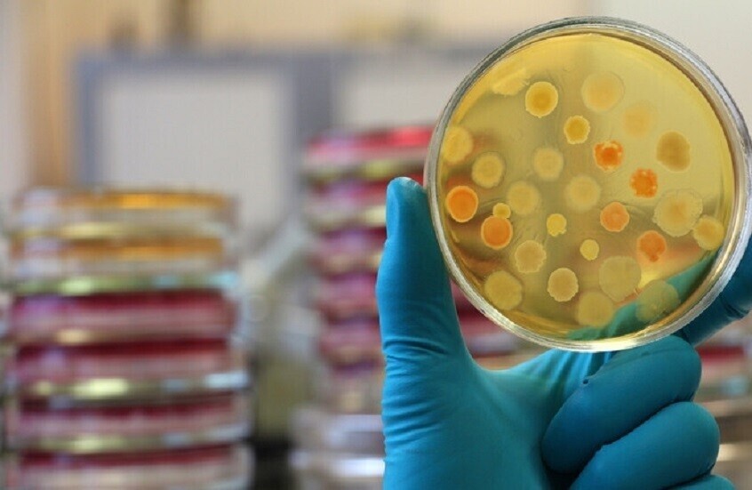 روسيا.. اكتشاف نقطة ضعف في البكتيريا المقاومة لمضادات الحيوية